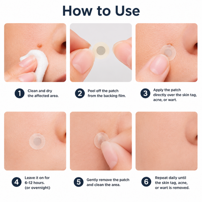 ✨Rainiste®2-in-1 Microneedle & Hydrocolloid Patch🍀| Removes Raised Moles, Acne, Flat Warts & Skin Tags | Helps Improve Wrinkles, Scars & Blemishes | Invisible Patches for Face & Body