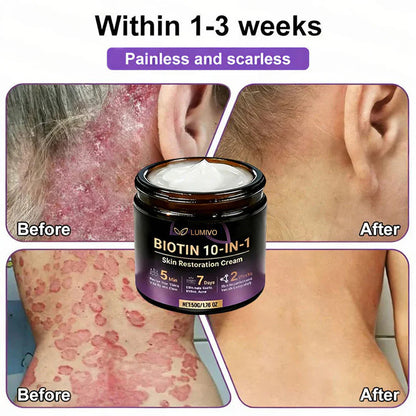 Made and Shipped from USA ✨LUMIVO™ Biotin 10-in-1 Skin Restoration Cream 🍀