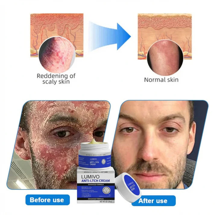 Magnesium Herbal Intimate – Multi‑Purpose Relief for Scalp Itching, Eczema, Jock Itch, Facial Acne & Fungal Infections | Herbal Extracts, Steroid‑Free, No Artificial Fragrances, Gentle for All Skin Types【Tax Free】