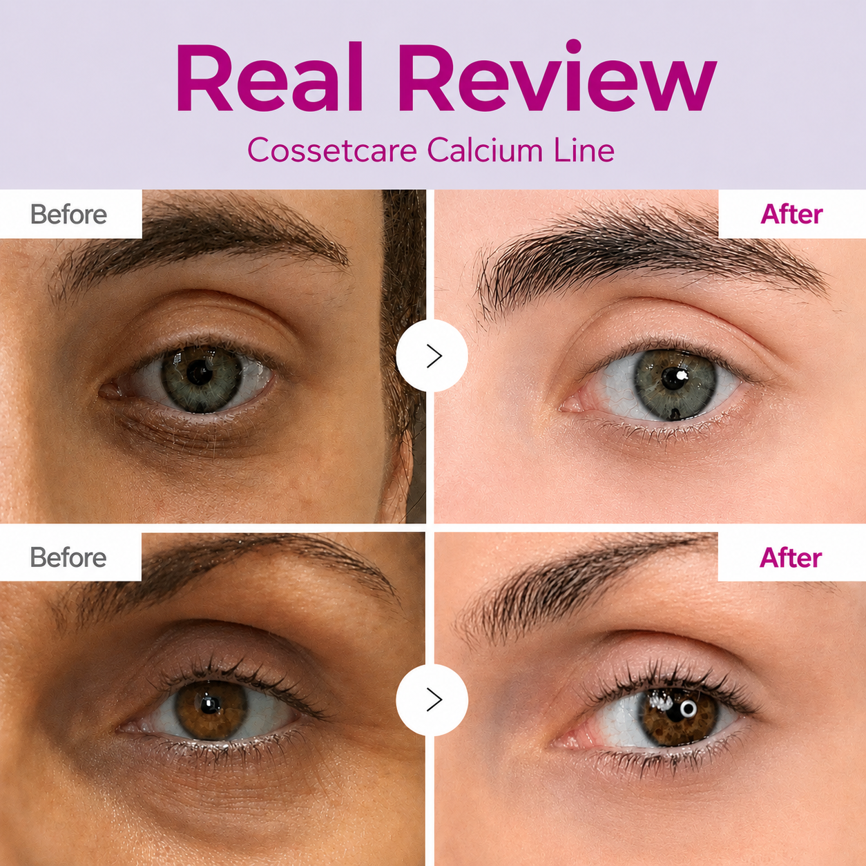 🔥LAST DAY 50% OFF!! Rainiste Korean Calcium Dark Spot Eye Cream