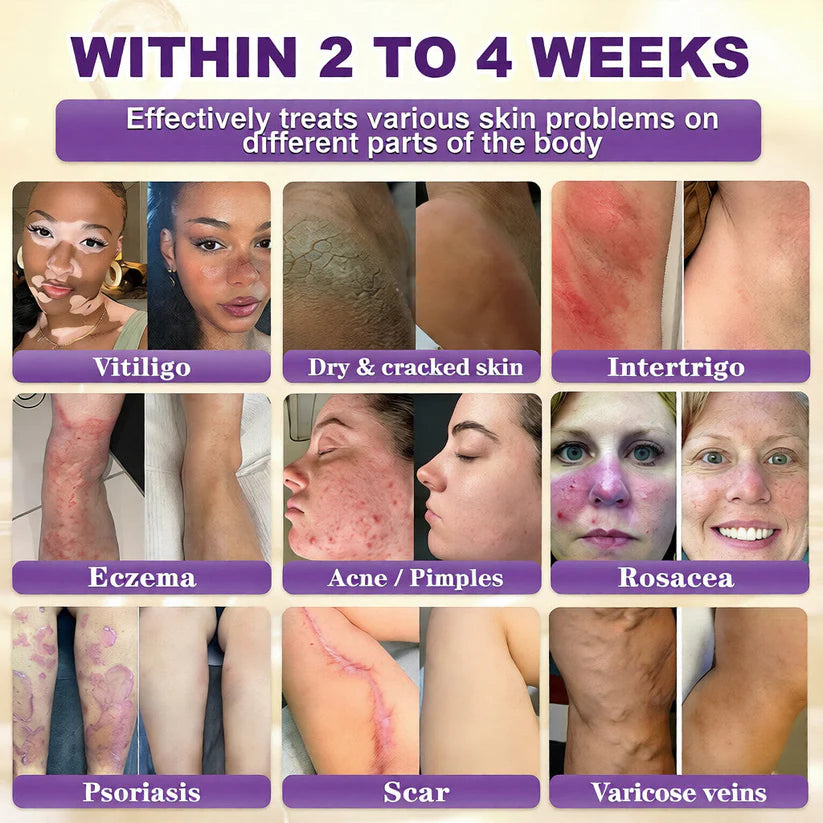 Made and Shipped from USA ✨LUMIVO™ Biotin 10-in-1 Skin Restoration Cream 🍀