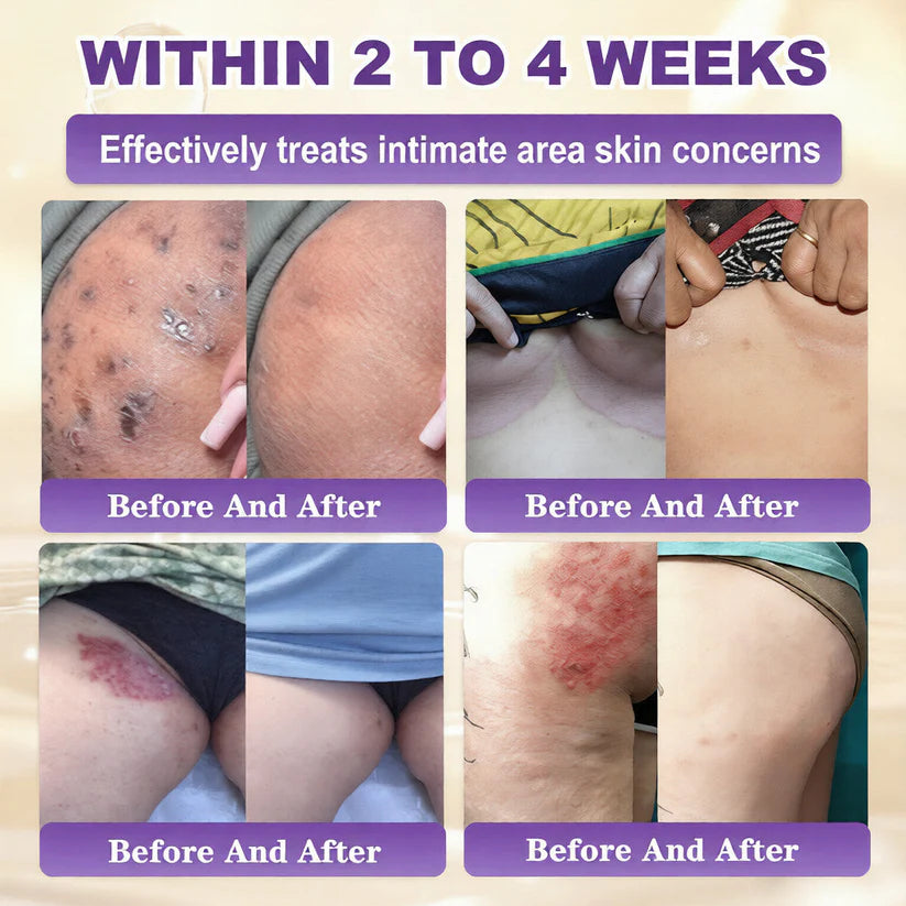 Made and Shipped from USA ✨LUMIVO™ Biotin 10-in-1 Skin Restoration Cream 🍀