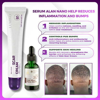 LUMIVO Scar Cream – Advanced Treatment for Raised & Keloid Scars