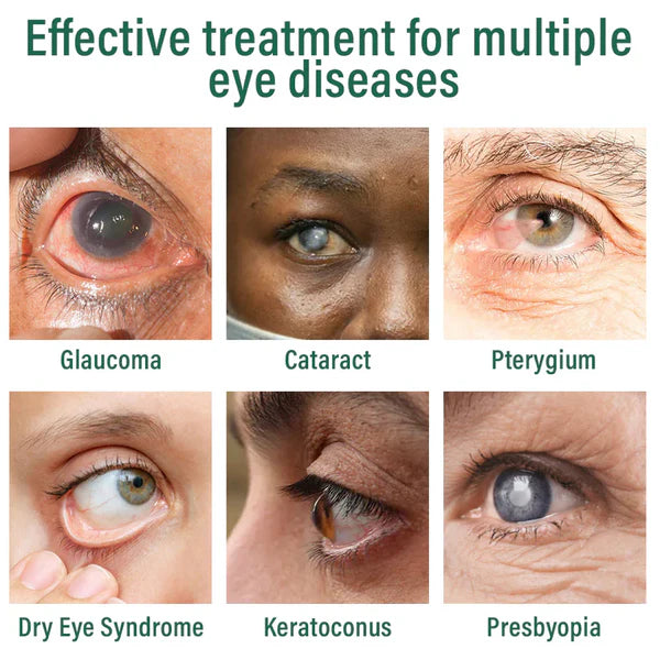 LUMIVO™ Nano Eye Drops Serum ✅FDA Approved(Suitable for presbyopia, dry eye syndrome, glaucoma, and cataracts) ☘️☘️