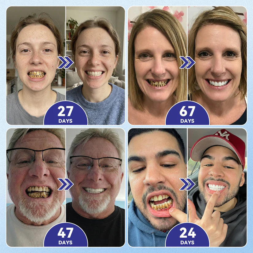 Next-Gen🦷LUMIVO™ 𝐓𝐢𝐝𝐞𝐠𝐥𝐮𝐬𝐢𝐛 𝐓𝐨𝐨𝐭𝐡 & 𝐆𝐮𝐦 𝐑𝐞𝐩𝐚𝐢𝐫 𝐌𝐢𝐜𝐫𝐨𝐧𝐞𝐞𝐝𝐥𝐞 𝐏𝐚𝐭𝐜𝐡 | 𝐀𝐝𝐯𝐚𝐧𝐜𝐞𝐝 𝐒𝐭𝐞𝐦-𝐂𝐞𝐥𝐥 𝐀𝐜𝐭𝐢𝐯𝐚𝐭𝐢𝐨𝐧 𝐓𝐞𝐞𝐭𝐡 𝐒𝐭𝐫𝐢𝐩𝐬(🦷𝐑𝐞𝐛𝐮𝐢𝐥𝐝 𝐄𝐧𝐚𝐦𝐞𝐥 & 𝐃𝐞𝐧𝐭𝐢𝐧 • 𝐒𝐭𝐫𝐞𝐧𝐠𝐭𝐡𝐞𝐧 𝐆𝐮𝐦𝐬 • 𝐄𝐫𝐚𝐝𝐢𝐜𝐚𝐭𝐞 𝐓𝐚𝐫𝐭𝐚𝐫 & 𝐎𝐝𝐨𝐫 • 𝐒𝐭𝐨𝐩 𝐓𝐨𝐨𝐭𝐡 𝐒𝐞𝐧𝐬𝐢𝐭𝐢𝐯𝐢𝐭𝐲)