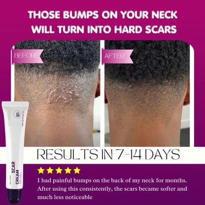 LUMIVO Scar Cream – Advanced Treatment for Raised & Keloid Scars
