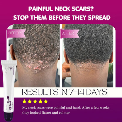 LUMIVO Scar Cream – Advanced Treatment for Raised & Keloid Scars