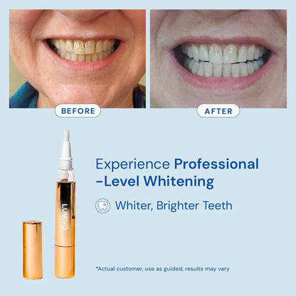 Extra-Strength Teeth Whitening Serum Pen
