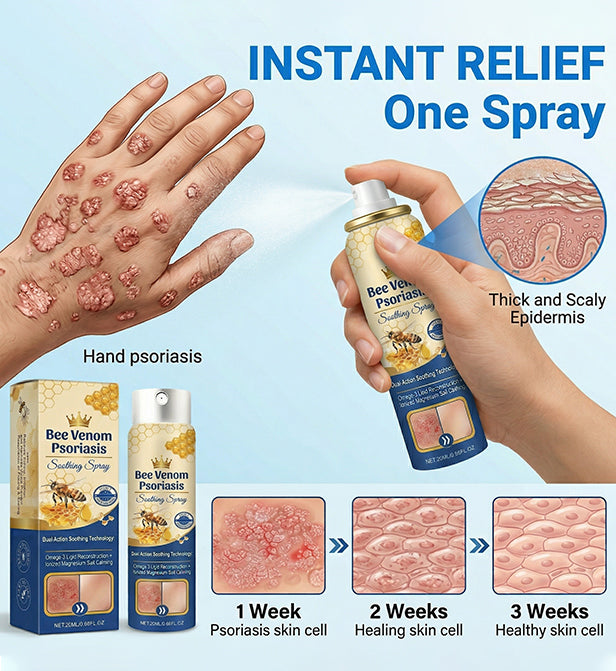 Advanced Recovery Mist: Triple-Active Relief for Psoriasis & Eczema-Prone Skin with Bee Venom & Omega-3【Free Tax】