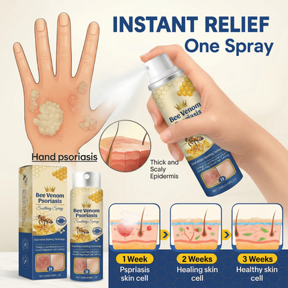 Advanced Recovery Mist: Triple-Active Relief for Psoriasis & Eczema-Prone Skin with Bee Venom & Omega-3【Free Tax】