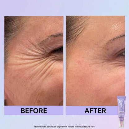 Final 3 Hours: 60%OFF🔥 Instant Lift Eye Gel for Puffiness, Bags & Dark Circles