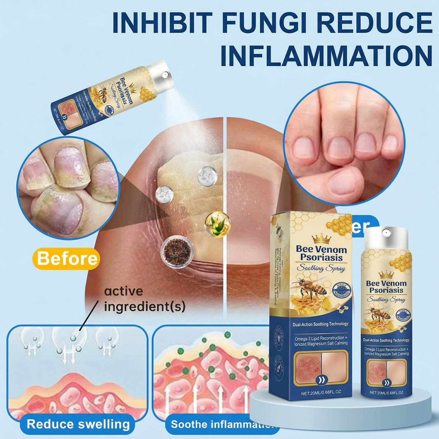 Advanced Recovery Mist: Triple-Active Relief for Psoriasis & Eczema-Prone Skin with Bee Venom & Omega-3【Free Tax】