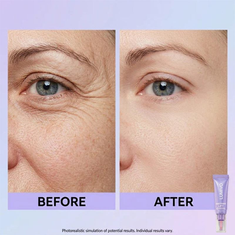 Final 3 Hours: 60%OFF🔥 Instant Lift Eye Gel for Puffiness, Bags & Dark Circles