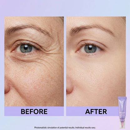 Final 3 Hours: 60%OFF🔥 Instant Lift Eye Gel for Puffiness, Bags & Dark Circles