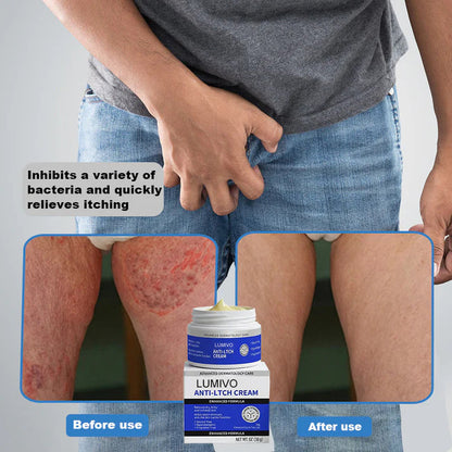 Magnesium Herbal Intimate – Multi‑Purpose Relief for Scalp Itching, Eczema, Jock Itch, Facial Acne & Fungal Infections | Herbal Extracts, Steroid‑Free, No Artificial Fragrances, Gentle for All Skin Types【Tax Free】