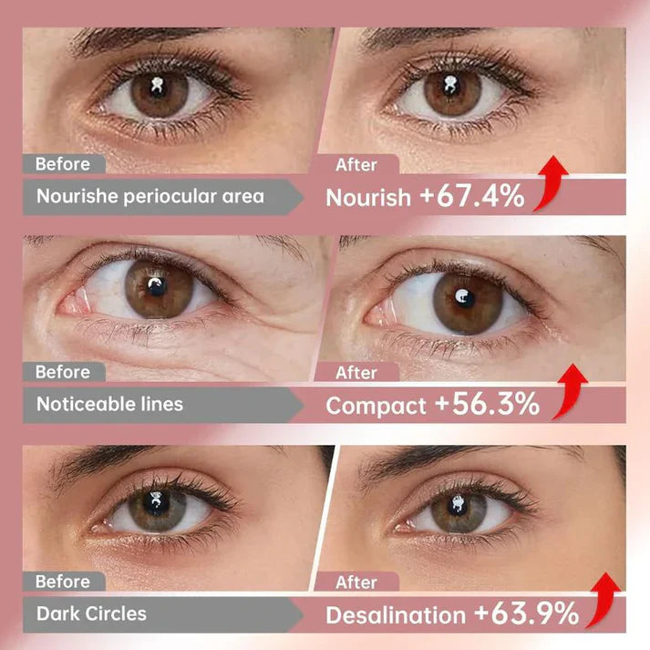 LUMIVO™ Cemenrete Calcium Volume Eye Patch for Sagging Under Eye Skin, Eye Mask Care for Wrinkles, Puffy Eyes & Dark Circles (60Patches)