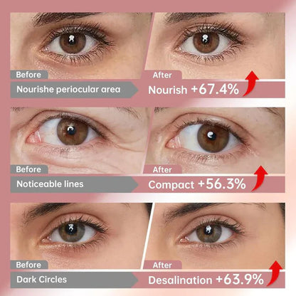 LUMIVO™ Cemenrete Calcium Volume Eye Patch for Sagging Under Eye Skin, Eye Mask Care for Wrinkles, Puffy Eyes & Dark Circles (60Patches)