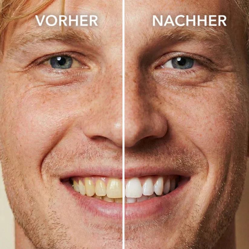 LUMIVO™ Tooth Polish
