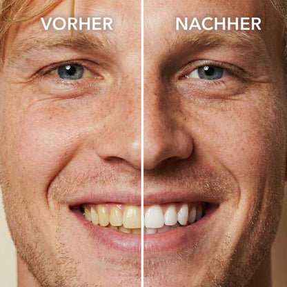 LUMIVO™ Tooth Polish