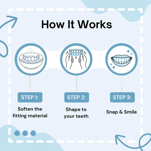 LUMIVO™ Clip-on Veneers