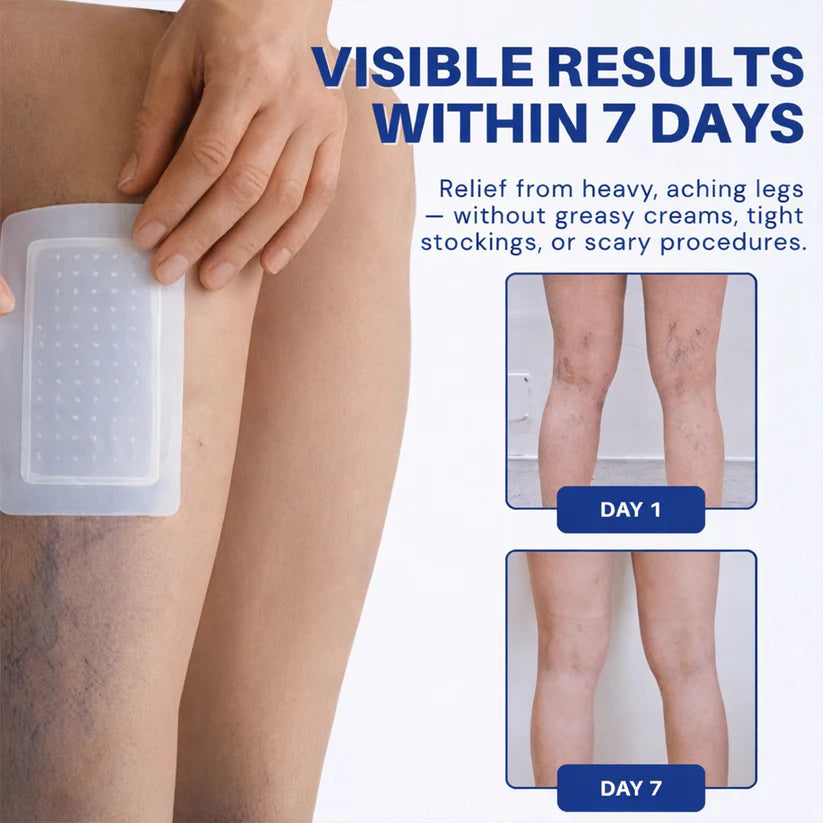 LUMIVO™ 𝑽𝗲𝗶𝙣 𝘾𝐨𝐧𝘁𝗼𝙪𝙧 𝙈𝙞𝐜𝐫𝒐𝒏𝒆𝗲𝗱𝗹𝙚 𝙋𝙖𝐭𝐜𝒉 𝒘𝒊𝘁𝗵 𝗔𝙙𝙫𝙖𝙣𝙘𝐞𝐝 𝐃𝒊𝒐𝒔𝗺𝙞𝐧 & 𝑯𝒆𝘀𝗽𝗲𝙧𝙞𝙙𝙞𝐧 𝐃𝒆𝒍𝒊𝒗𝗲𝗿𝙮🌿𝟕-𝐃𝐚𝐲 𝐕𝐢𝐬𝐢𝐛𝐥𝐞 𝐑𝐞𝐬𝐮𝐥𝐭𝐬 𝐟𝐨𝐫 𝐕𝐚𝐫𝐢𝐜𝐨𝐬𝐞 𝐕𝐞𝐢𝐧𝐬