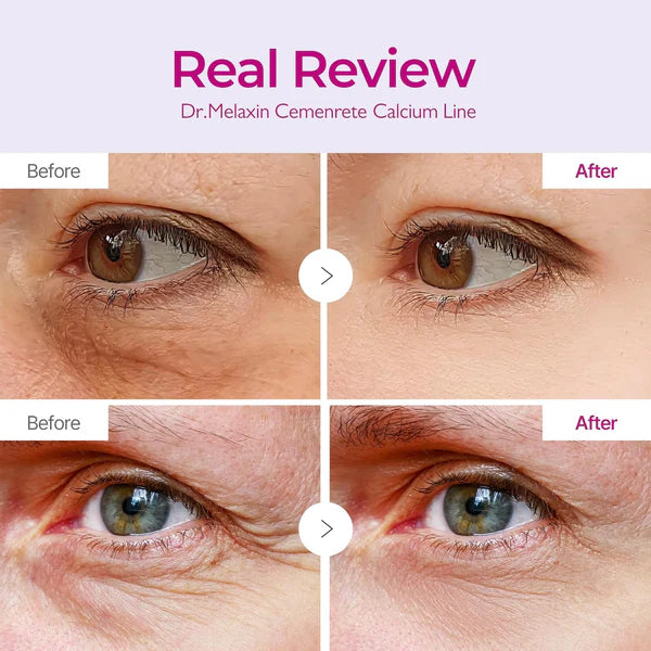 LUMIVO™ Cemenrete Calcium Volume Eye Patch for Sagging Under Eye Skin, Eye Mask Care for Wrinkles, Puffy Eyes & Dark Circles (60Patches)