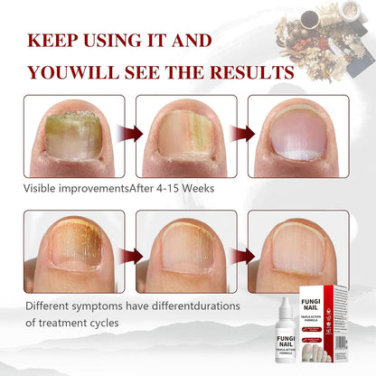 Night Repair Toenail Rescue Drops