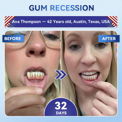Next-Gen🦷LUMIVO™ 𝐓𝐢𝐝𝐞𝐠𝐥𝐮𝐬𝐢𝐛 𝐓𝐨𝐨𝐭𝐡 & 𝐆𝐮𝐦 𝐑𝐞𝐩𝐚𝐢𝐫 𝐌𝐢𝐜𝐫𝐨𝐧𝐞𝐞𝐝𝐥𝐞 𝐏𝐚𝐭𝐜𝐡 | 𝐀𝐝𝐯𝐚𝐧𝐜𝐞𝐝 𝐒𝐭𝐞𝐦-𝐂𝐞𝐥𝐥 𝐀𝐜𝐭𝐢𝐯𝐚𝐭𝐢𝐨𝐧 𝐓𝐞𝐞𝐭𝐡 𝐒𝐭𝐫𝐢𝐩𝐬(🦷𝐑𝐞𝐛𝐮𝐢𝐥𝐝 𝐄𝐧𝐚𝐦𝐞𝐥 & 𝐃𝐞𝐧𝐭𝐢𝐧 • 𝐒𝐭𝐫𝐞𝐧𝐠𝐭𝐡𝐞𝐧 𝐆𝐮𝐦𝐬 • 𝐄𝐫𝐚𝐝𝐢𝐜𝐚𝐭𝐞 𝐓𝐚𝐫𝐭𝐚𝐫 & 𝐎𝐝𝐨𝐫 • 𝐒𝐭𝐨𝐩 𝐓𝐨𝐨𝐭𝐡 𝐒𝐞𝐧𝐬𝐢𝐭𝐢𝐯𝐢𝐭𝐲)